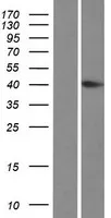 HYKK (NM_001013619) Human Over-expression Lysate - image 1