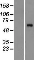 Complement C8A (C8A) (NM_000562) Human Over-expression Lysate - image 1