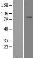Plasminogen (PLG) (NM_000301) Human Over-expression Lysate - image 1