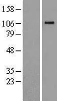 Complement Component 6 (C6) (NM_001115131) Human Over-expression Lysate - image 1