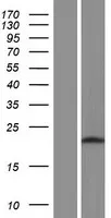 ATPBD4 (DPH6) (NM_001141972) Human Over-expression Lysate - image 1