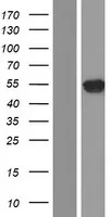 Doublecortin (DCX) (NM_001195553) Human Over-expression Lysate - image 1