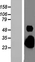 Plaur (BC010309) Mouse Over-expression Lysate - image 1