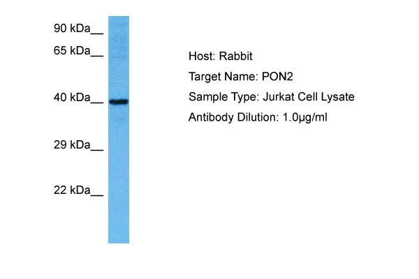 PON2 Rabbit Polyclonal Antibody - image 1
