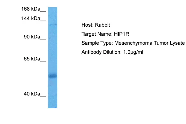 HIP1R Rabbit Polyclonal Antibody - image 1