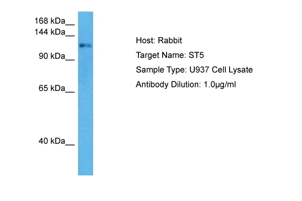 DENND2B Rabbit Polyclonal Antibody - image 1