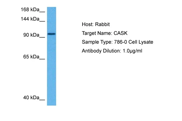 CASK Rabbit Polyclonal Antibody - image 1