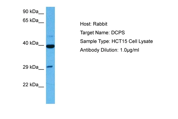 DCPS Rabbit Polyclonal Antibody - image 1