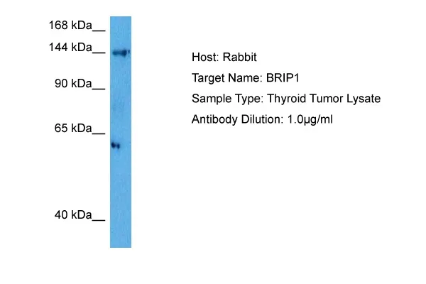 BRIP1 Rabbit Polyclonal Antibody - image 1