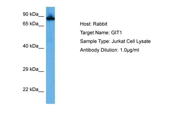 GIT1 Rabbit Polyclonal Antibody - image 1