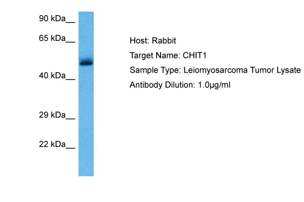 CHIT1 Rabbit Polyclonal Antibody - image 1
