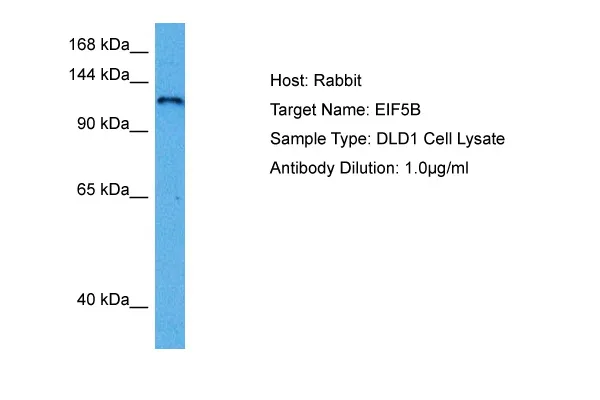 EIF5B Rabbit Polyclonal Antibody - image 1