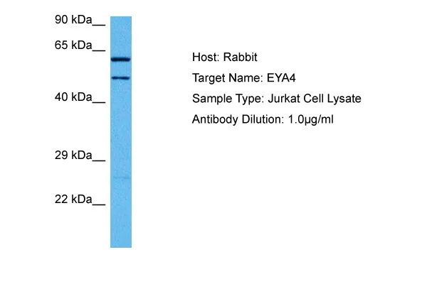 EYA4 Rabbit Polyclonal Antibody - image 1
