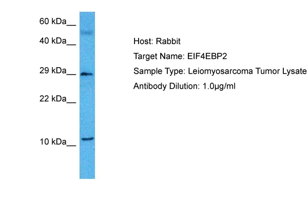EIF4EBP2 Rabbit Polyclonal Antibody - image 1