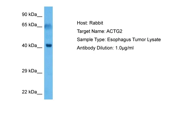 ACTG2 Rabbit Polyclonal Antibody - image 1