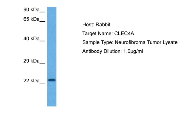 CLECSF6 (CLEC4A) Rabbit Polyclonal Antibody - image 1