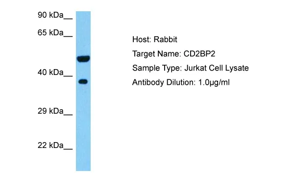 CD2BP2 Rabbit Polyclonal Antibody - image 1