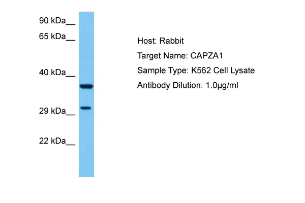 CAPZA1 Rabbit Polyclonal Antibody - image 1