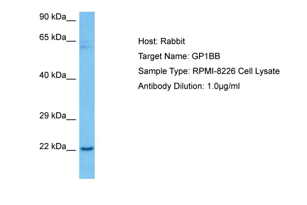 CD42c (GP1BB) Rabbit Polyclonal Antibody - image 1