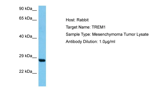 TREM1 Rabbit Polyclonal Antibody - image 1