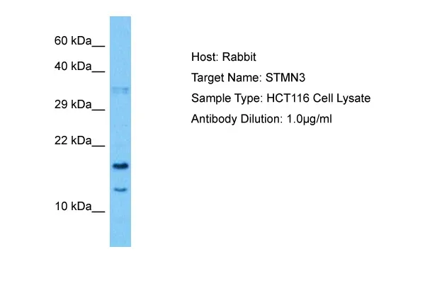STMN3 Rabbit Polyclonal Antibody - image 1