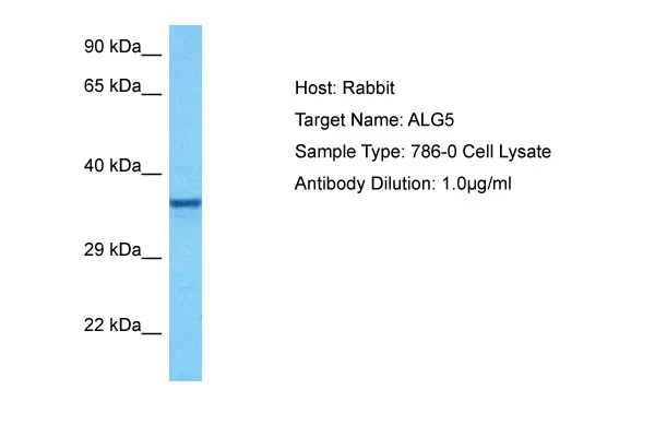 ALG5 Rabbit Polyclonal Antibody - image 1
