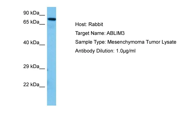 ABLIM3 Rabbit Polyclonal Antibody - image 1
