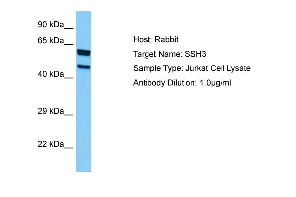 SSH3 Rabbit Polyclonal Antibody - image 1