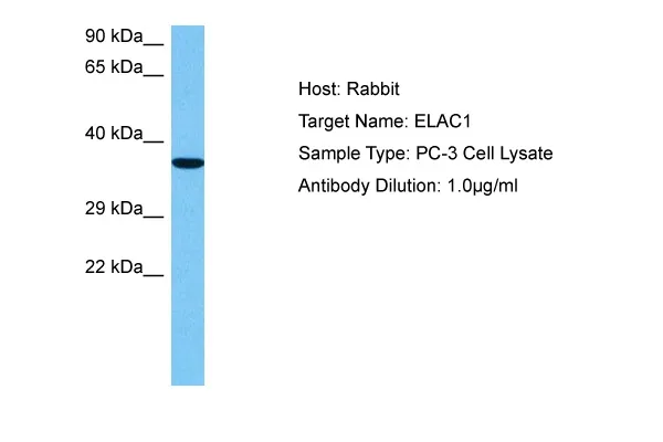 ELAC1 Rabbit Polyclonal Antibody - image 1
