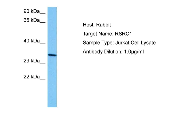RSRC1 Rabbit Polyclonal Antibody - image 1