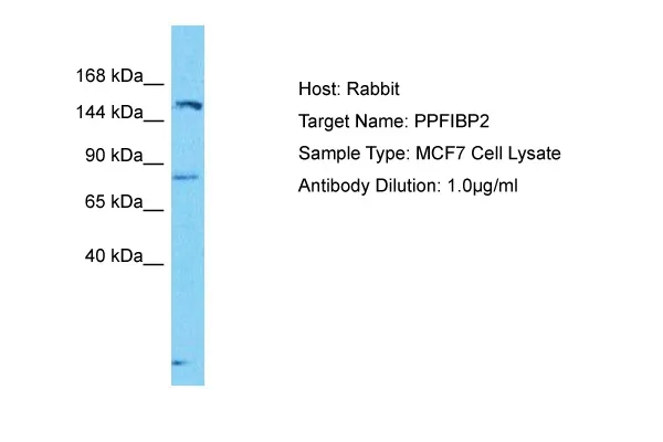 PPFIBP2 Rabbit Polyclonal Antibody - image 1