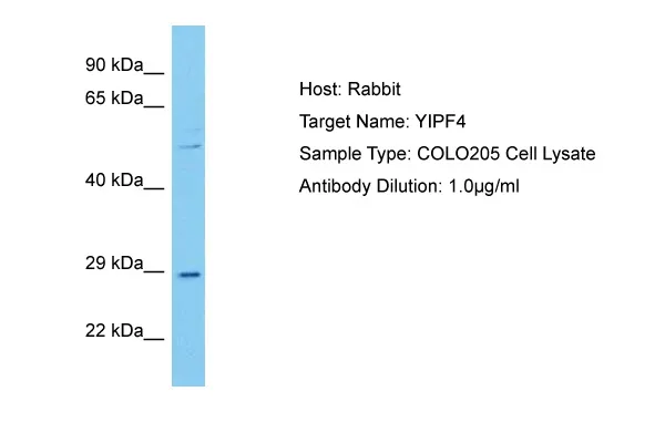 YIPF4 Rabbit Polyclonal Antibody - image 1