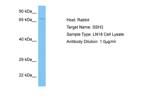 SSH3 Rabbit Polyclonal Antibody - image 1