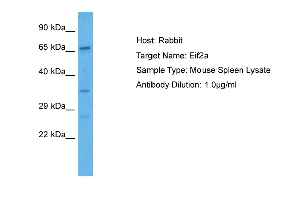 Eif2a Rabbit Polyclonal Antibody - image 1