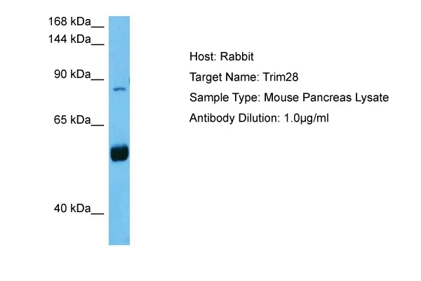 Trim28 Rabbit Polyclonal Antibody - image 1