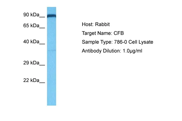Complement factor B (CFB) Rabbit Polyclonal Antibody - image 1