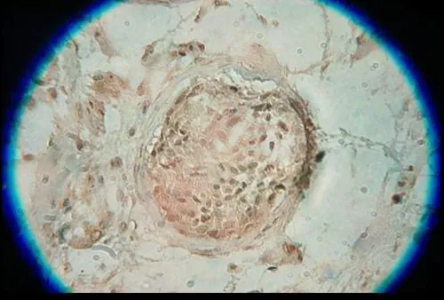 BAGE Rabbit Polyclonal Antibody - image 1