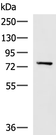 Calpain 5 (CAPN5) Rabbit Polyclonal Antibody - image 1