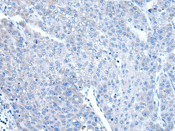 DAP1 (DAP) Rabbit Polyclonal Antibody - image 1