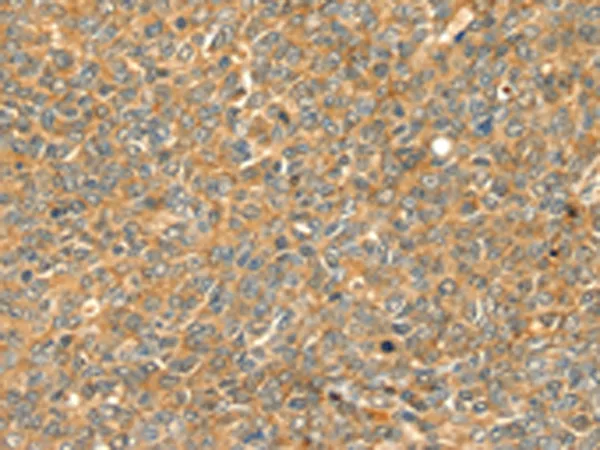 GRB2 Rabbit Polyclonal Antibody - image 1