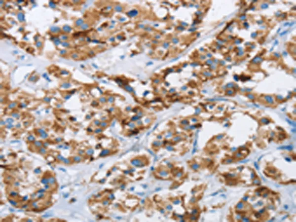 HINT2 Rabbit Polyclonal Antibody - image 1