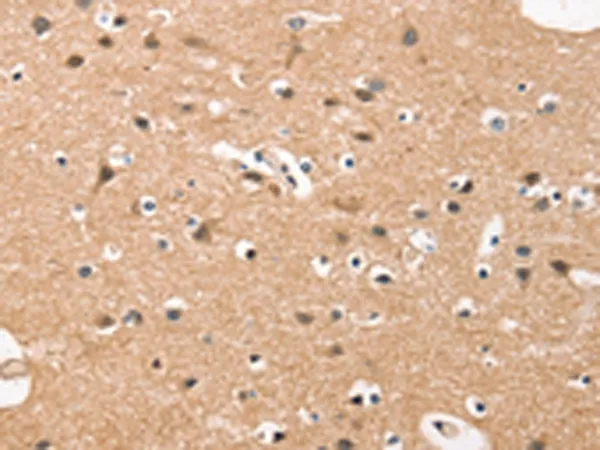 HDAC8 Rabbit Polyclonal Antibody - image 1