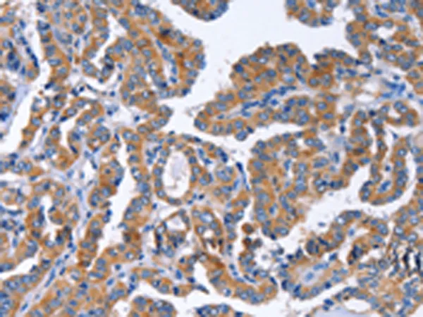 IGSF10 Rabbit Polyclonal Antibody - image 1