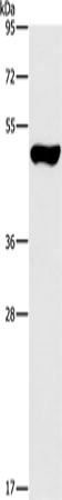 Integrin Linked Kinase (ILK) Rabbit Polyclonal Antibody - image 1
