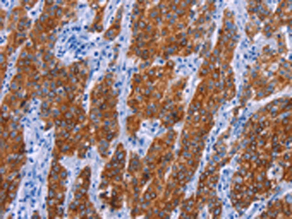 Nurr1 (NR4A2) Rabbit Polyclonal Antibody - image 1