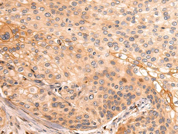 SFTPC Rabbit Polyclonal Antibody - image 1
