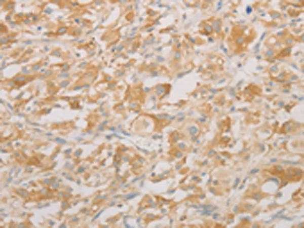 Amino terminal enhancer of split (AES) Rabbit Polyclonal Antibody - image 1