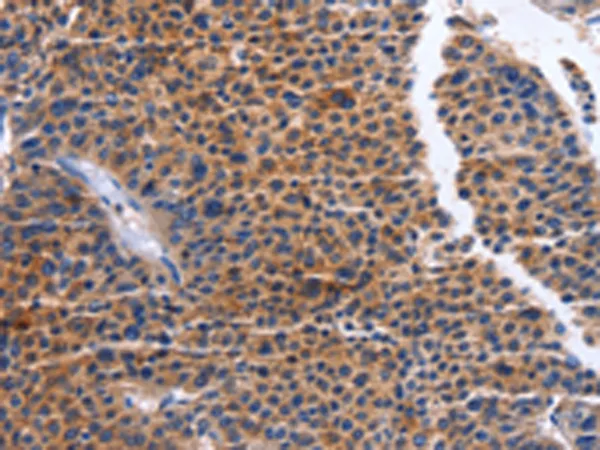 MAP3K13 Rabbit Polyclonal Antibody - image 1