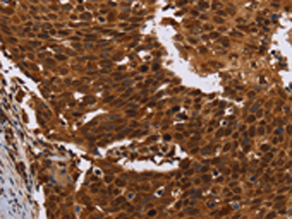 FANCF Rabbit Polyclonal Antibody - image 1