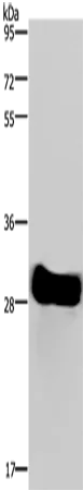 FHL2 Rabbit Polyclonal Antibody - image 1
